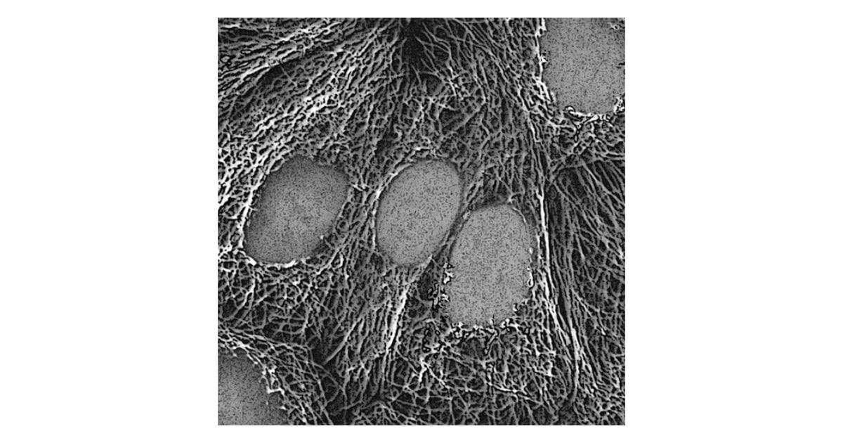 HeLa cell microtubules, six-field TI Workbench sequence (.dts)