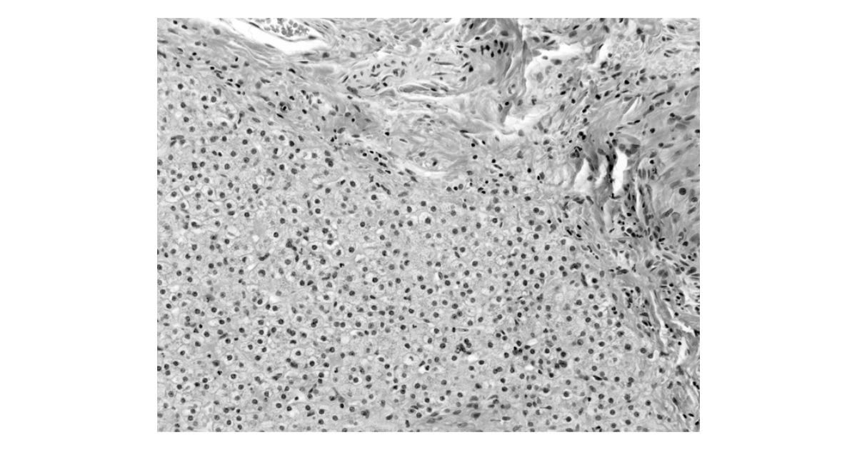 Liver tissue section, TI Workbench image (.dtf)