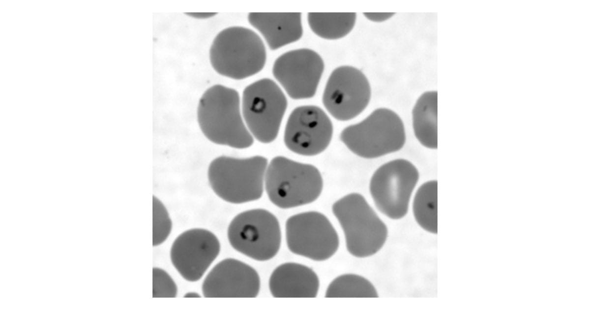 Malaria parasites in a blood smear, TI Workbench image (.dtf)