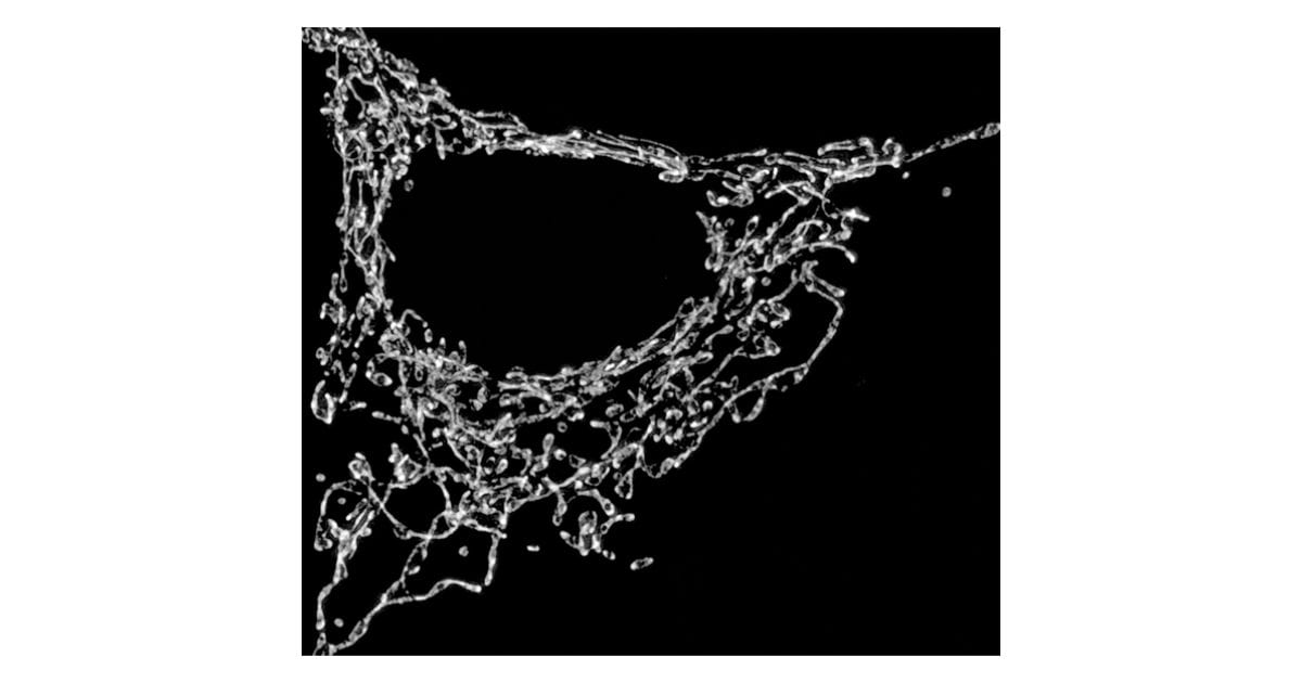 Mitochondrial network in a cell, TI Workbench image (.dtf)